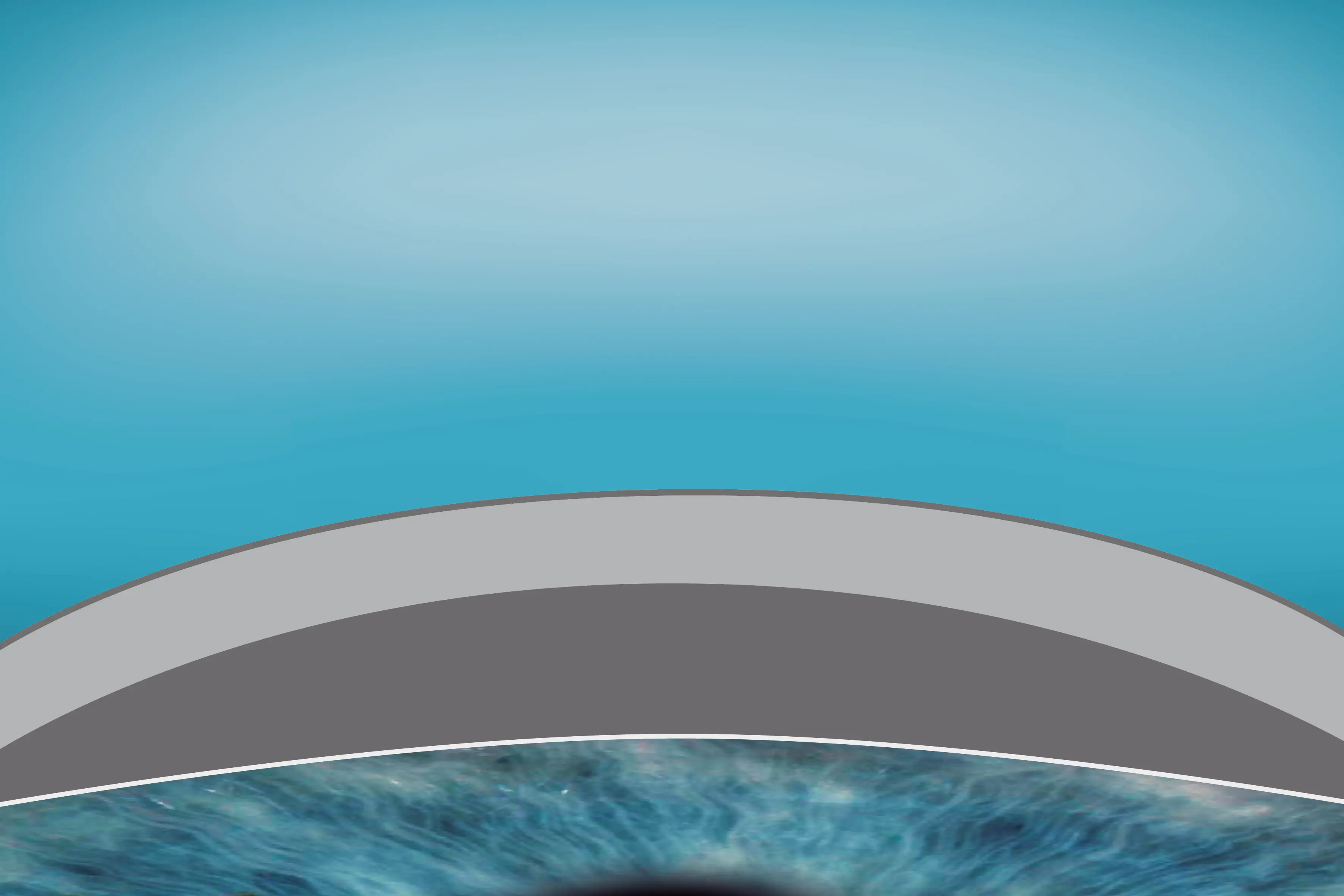 Illustration einer normalen Hornhaut vor dem SmartSurfACE-Verfahren