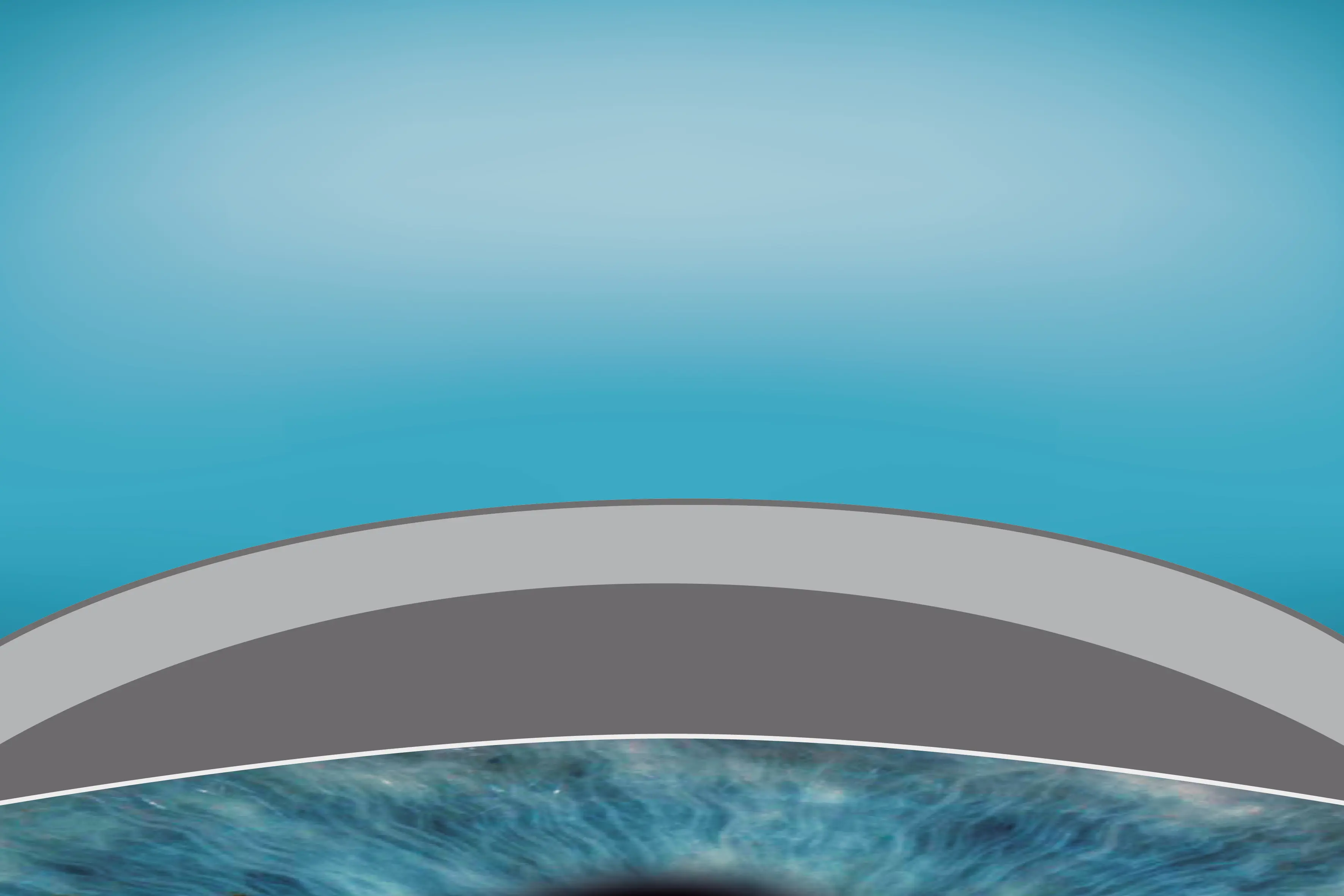 Illustration einer regenerierten Hornhaut nach dem SmartSurfACE-Verfahren